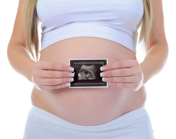 Kaunis nuori raskaana oleva nainen - Valokuva, kuva