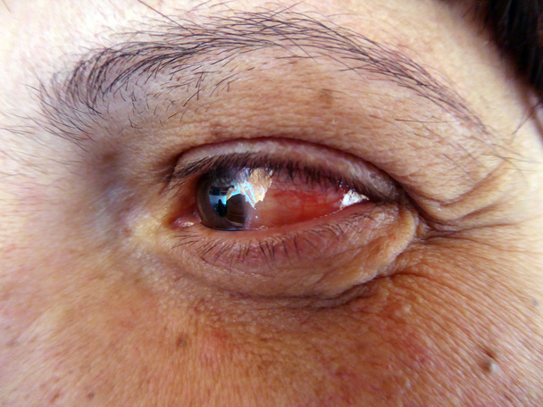 ιατρική υγειονομικής περίθαλψης αίμα τριχοειδή ανθρώπινο μάτι  - Φωτογραφία, εικόνα