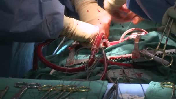 Kirurginen ryhmä käytön aikana
 - Materiaali, video