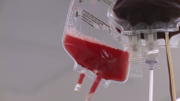 Drip bags during surgery - Filmati, video