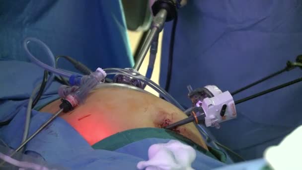 Chirurgové operace lékařský - Záběry, video