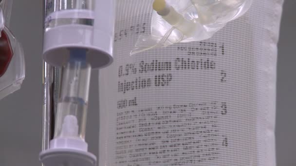 Natriumchlorid tropft während der Operation - Filmmaterial, Video