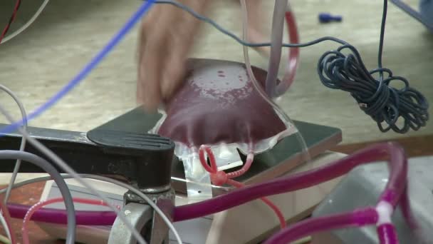 Saco de sangue de histerectomia robótica
 - Filmagem, Vídeo