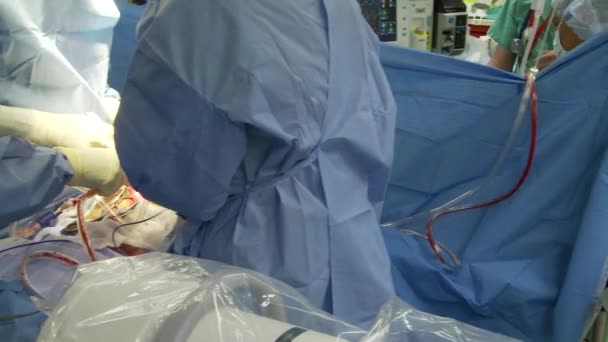 Blick in einen typischen Operationssaal eines Krankenhauses - Filmmaterial, Video