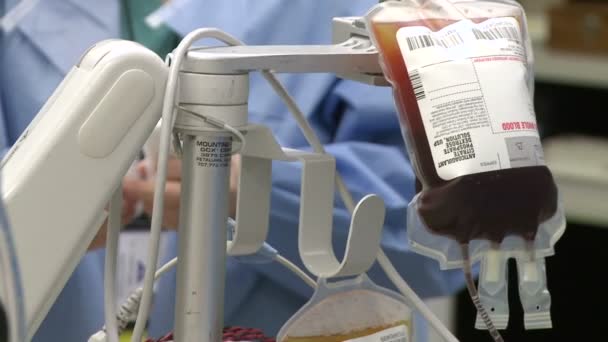 iv Beutel Gerinnungshemmer während der Operation - Filmmaterial, Video