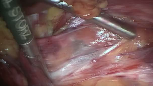 Chirurgové projít přes tkáň - Záběry, video