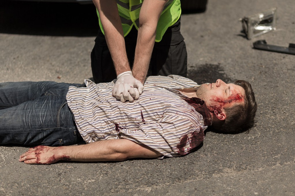 Car accident casualty - Foto, Imagen