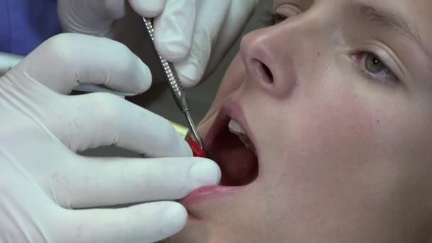 стоматолог практикує місцеву анестезію
 - Кадри, відео