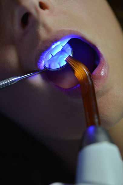 Kobieta w trakcie procedury stomatologiczne - Zdjęcie, obraz