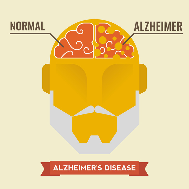 Alzheimer - Vecteur, image