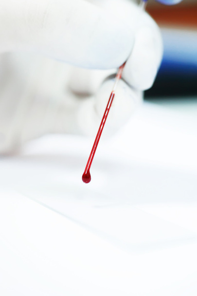 blood testing in laboratory - Foto, imagen