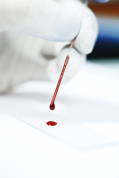 blood testing in laboratory - Fotografie, Obrázek