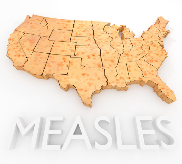 Measles Return To The US - Photo, Image