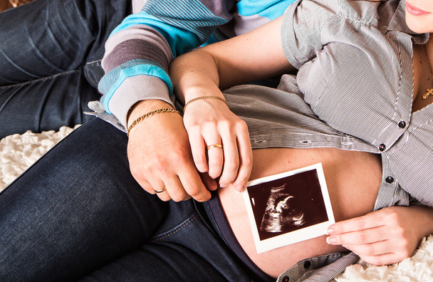 Young  couple holding an ultrasound scan of their expecting baby  - Photo, Image