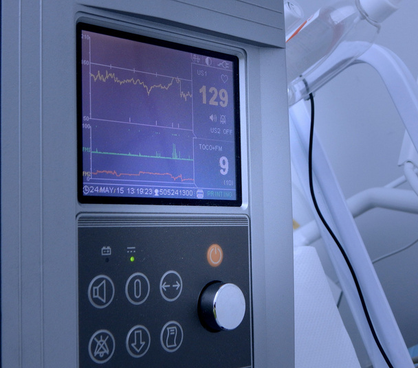 Kardiotokograf stanovení a tisk grafy srdeční frekvence - Fotografie, Obrázek