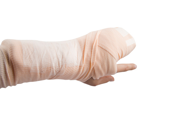 Femme os de la main cassé lors d'un accident d'urgence
 - Photo, image