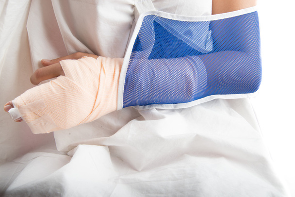 Женщина сломала кость руки после несчастного случая с перевязью руки
 - Фото, изображение