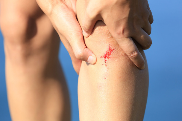 sports injured leg - Фото, изображение