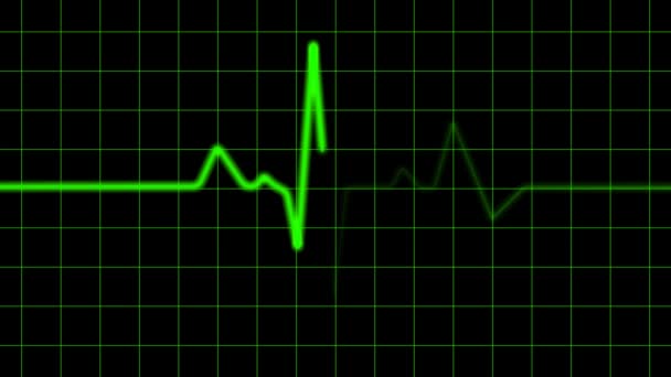 Zöld szív Monitor - Felvétel, videó