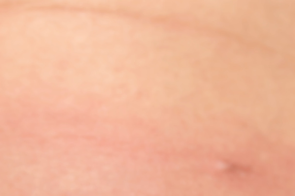 Textura da pele humana com pêlos pretos na pele para costas saudáveis
 - Foto, Imagem