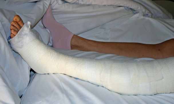 chodidel a nohou ovázané po operaci - Fotografie, Obrázek