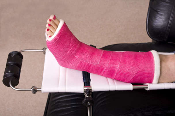 Señora con la pierna fracturada
 - Foto, Imagen