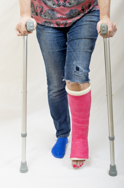 Σπασμένο πόδι και δεκανίκια - Φωτογραφία, εικόνα