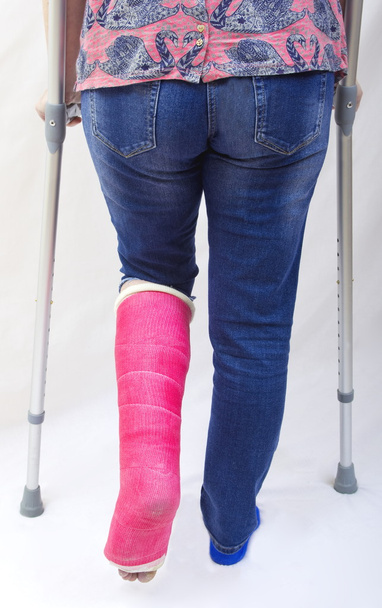 зламана нога і милиці
 - Фото, зображення