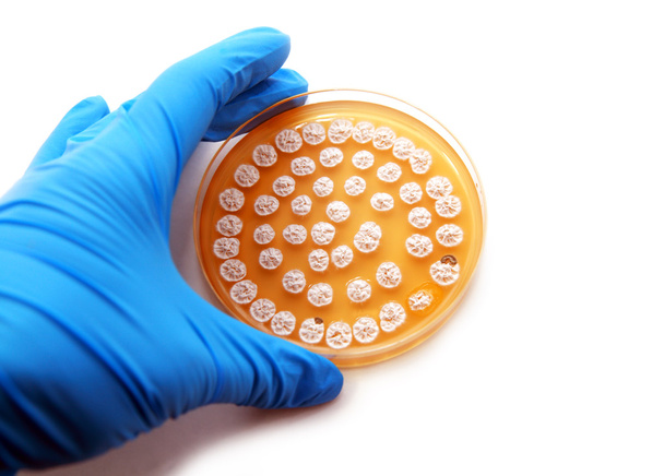 microbiologische plaat met schimmels - Foto, afbeelding