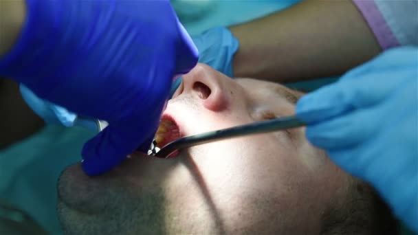 dentist drills the jaw - Filmmaterial, Video