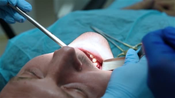 Dentist  scissors cuts the thread - Materiał filmowy, wideo