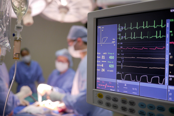 monitor serca w szpitalu sali operacyjnej - Zdjęcie, obraz