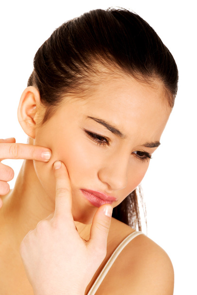 Teenage woman squeezing pimple. - Zdjęcie, obraz