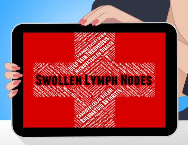 Swollen Lymph Nodes Represents Poor Health And Lymphadenopathy - Fotó, kép