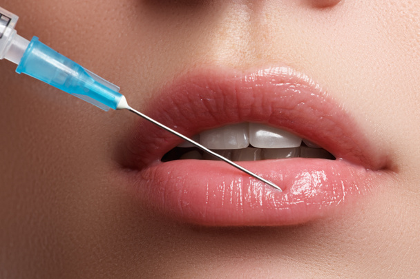 Closeup of beautiful woman gets injection in her lips. Full lips. Beautiful face and the syringe (plastic surgery and cosmetic injection concept). Botox injections. - 写真・画像