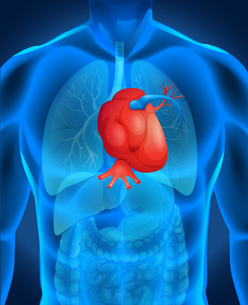 Heart disease diagram in human - Wektor, obraz