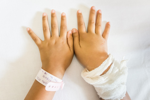 Child Hand Swollen After Infusion - Photo, Image