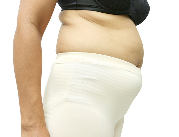 Kövér nők - Fotó, kép