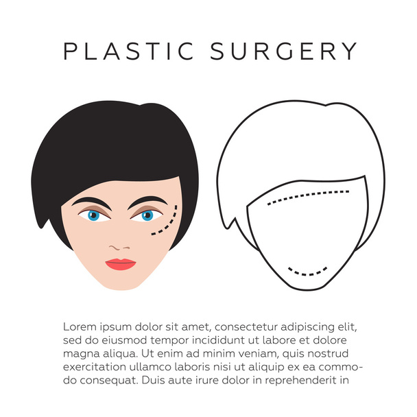 Plasztikai sebészet infographics, vektoros illusztráció - Vektor, kép