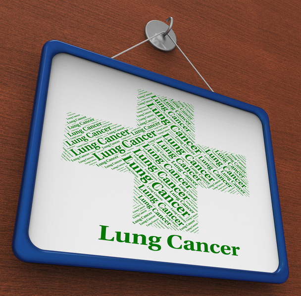 Rak płuc wskazuje złośliwy rozrost i dolegliwości - Zdjęcie, obraz