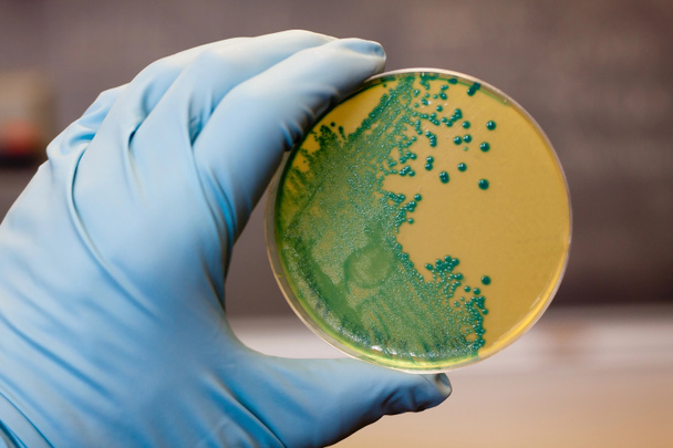 Listeria Bacterias
 - Foto, Imagen