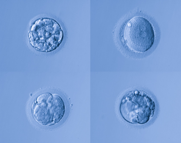 ανθρώπινα κύτταρα αυγών - Φωτογραφία, εικόνα
