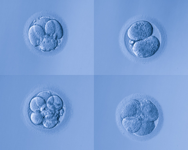 uovo di cellule umane
 - Foto, immagini