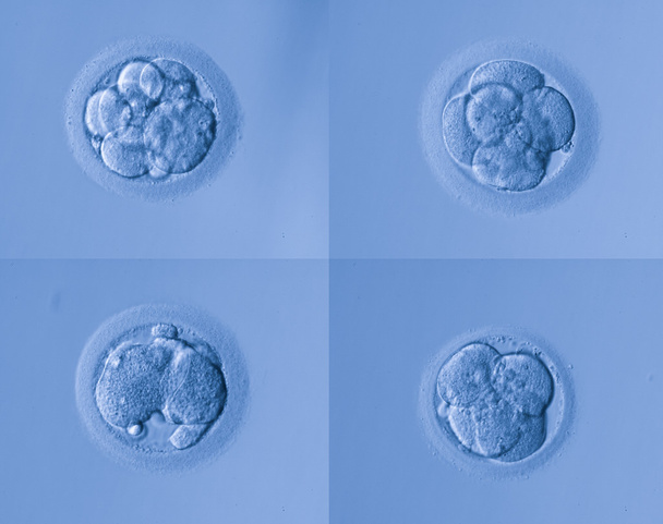 emberi sejtek tojás - Fotó, kép