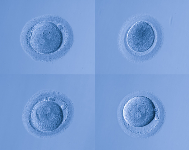 óvulos humanos
 - Foto, Imagen