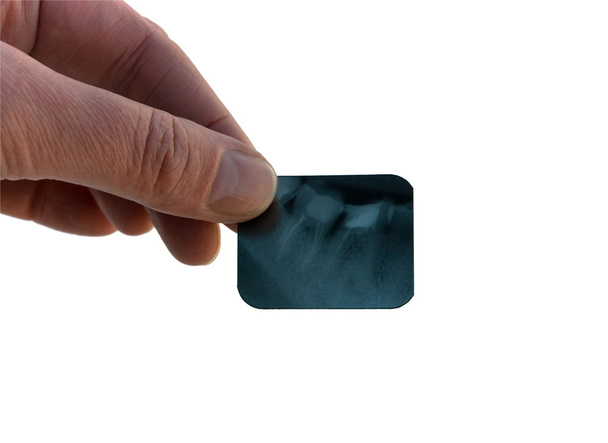 Dental X-ray - Foto, Imagem
