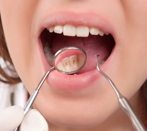 Trattamento dentale - Foto, immagini
