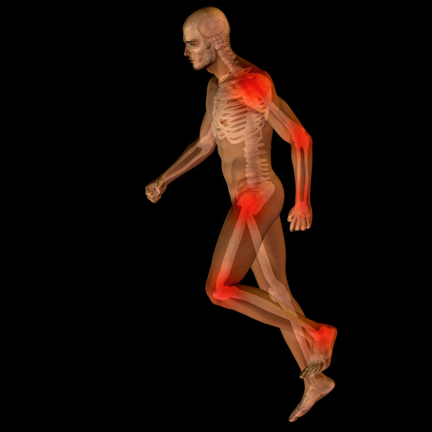 anatomía del hombre con dolor
 - Foto, imagen