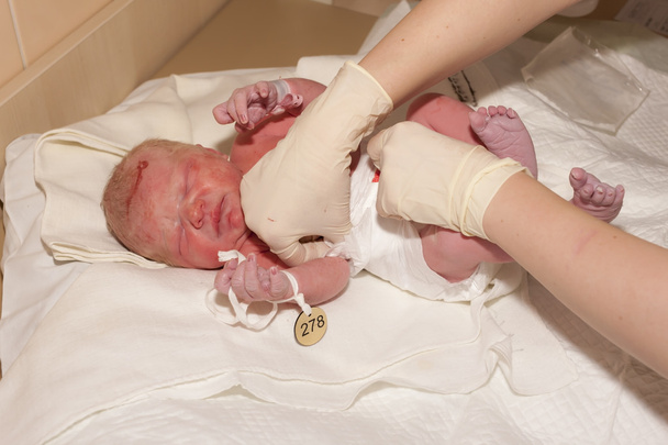 лікування новонароджених
 - Фото, зображення