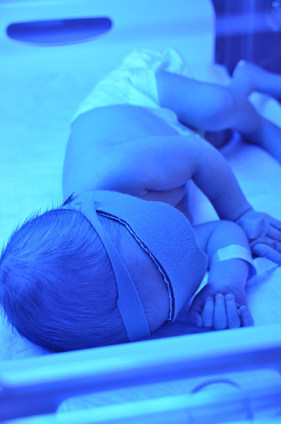 新生児黄疸 - 写真・画像
